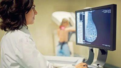 Žena radi mamografski pregled