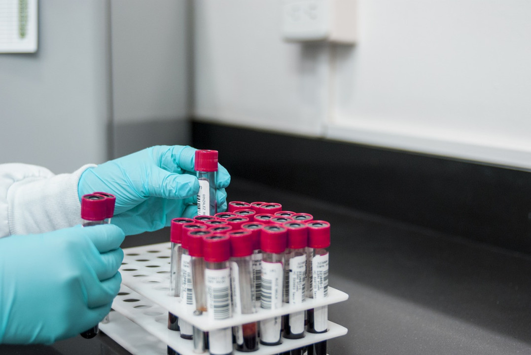 testovi/ pixabay laboratorija/koronavirs